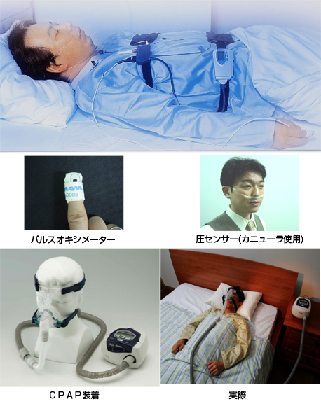 睡眠時無呼吸症候群